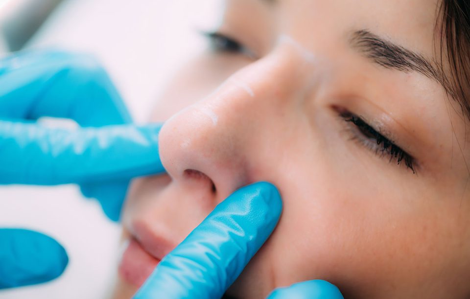 dermal-fillers-anti-aging-treatment-2026-01-05-23-01-08-utc